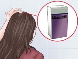 4 Cara Mengobati Rambut Rontok Dengan Bawang Putih